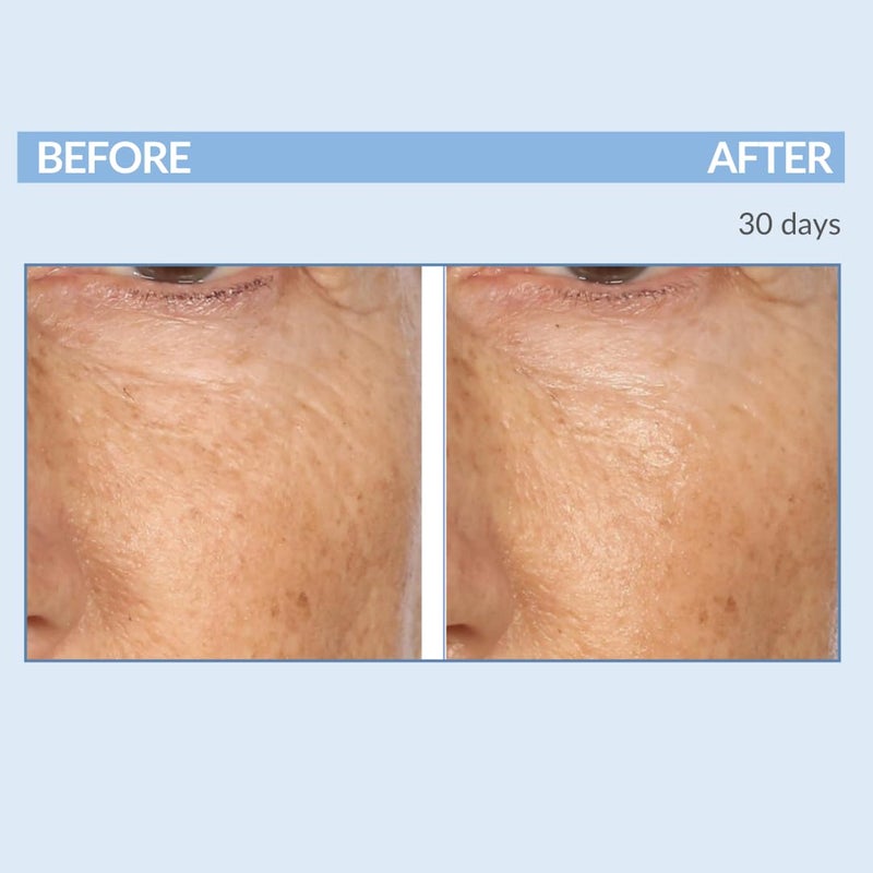 Serious Skincare Retinol Fine Lines and Wrinkles Skin Care Set A Force XR Serum and A Cream XR Moisture Cream for Face AntiAging Minimize Post Acne Marks Resurface and Hydrate Serious Skincare - Image 3