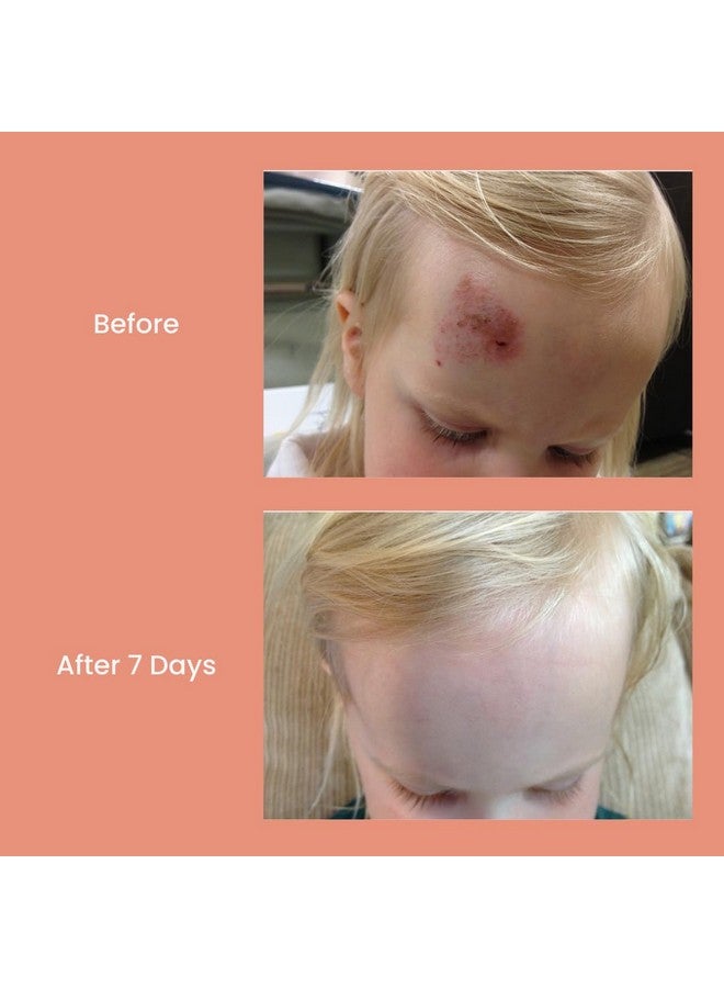 TrueLipids CLMD - بلسم بو-بو وبام - بلسم مهدئ للأطفال لالتهابات الحفاضات، الجروح، الخدوش والحروق - غير سام، مضاد للحساسية - تخفيف عضوي للبشرة - 1.7 أونصة سائلة - Image 3