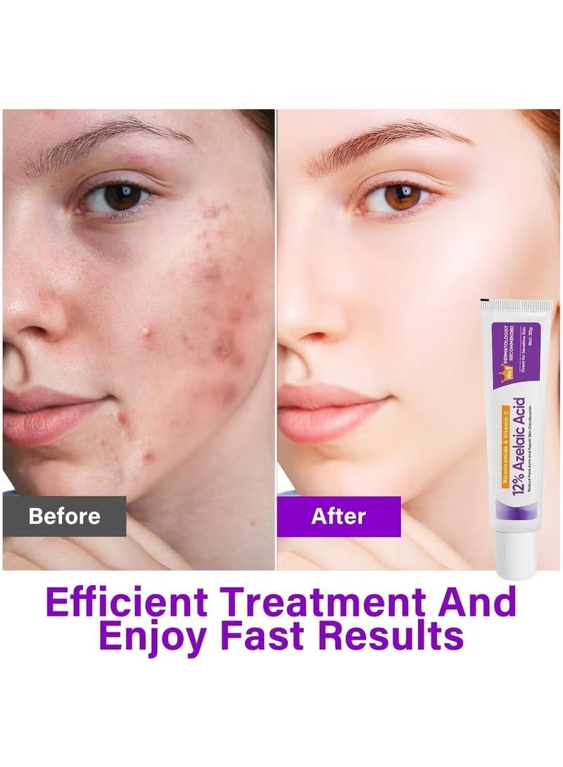 ATRJSZ Azelaic Acid Serum, 12% Azelaic Acid, Hyaluronic Acid & Niacinamide, Redness Relief Face, Moisturizing and Balance Excess Sebum, Reducing Blemish & Rosacea Acne, for Sensitive Skin - Image 3