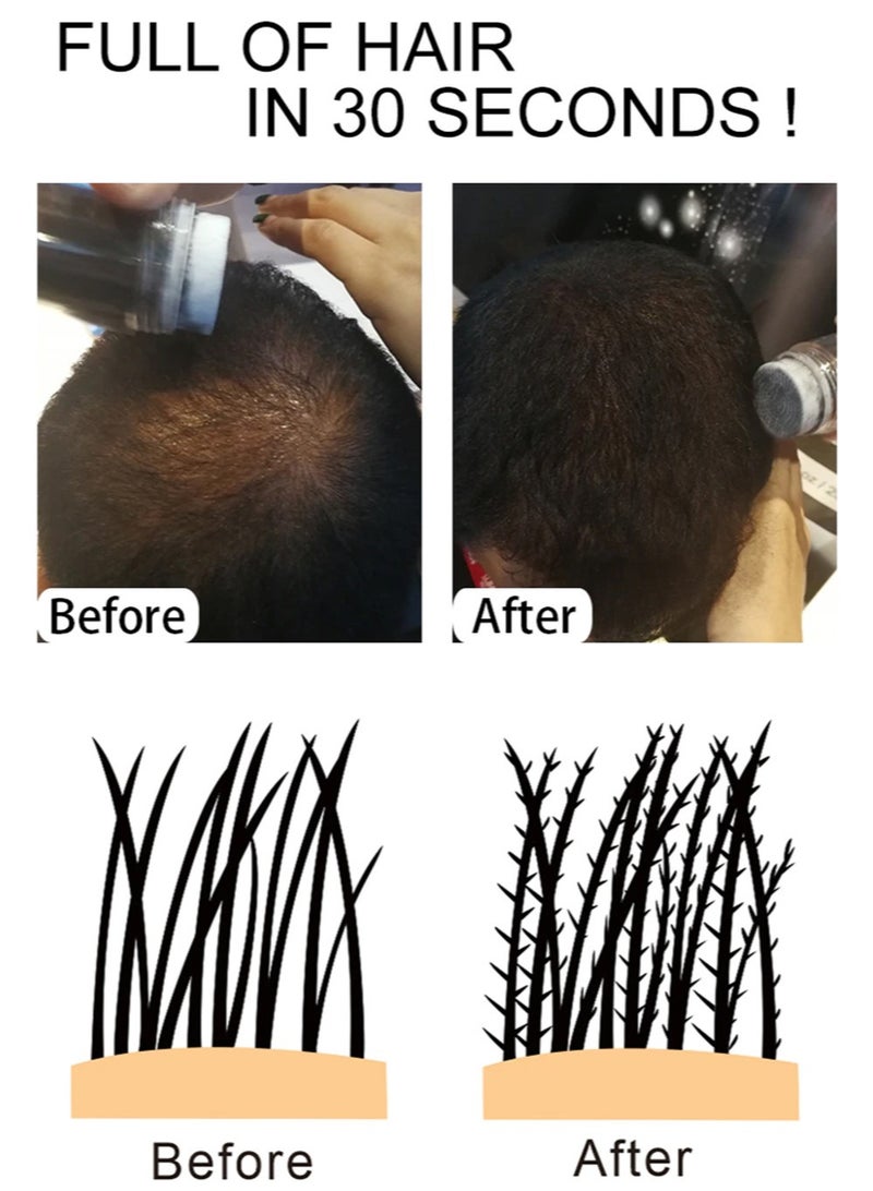 Sevich Hair Building Fibers, Natural Concealing Hair Building Fiber, Keratin Thicker Anti Hairs Loss Thickening Fiber Powders For Hair Growth Thickness And Styling, (1pc, Black) - Image 4