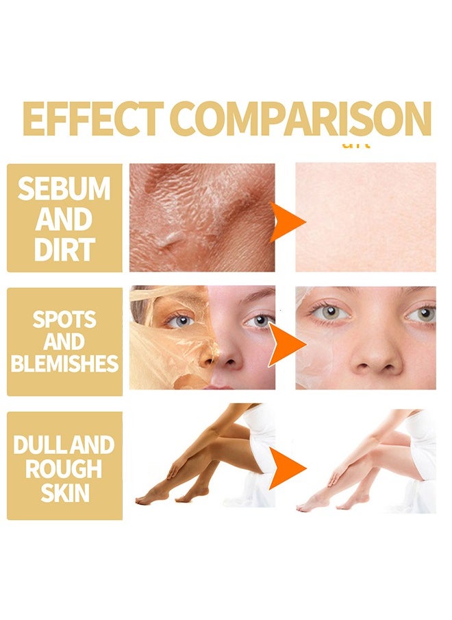 OUHOE Extra Strong Peeling Oil,Skin Whitening Stretoh Marks Remover Peeling Solution With Salicylic Acid, Dark Spot Corrector For Body, Skin Brightening Solution For Dull Skin (110Ml)  - Image 5