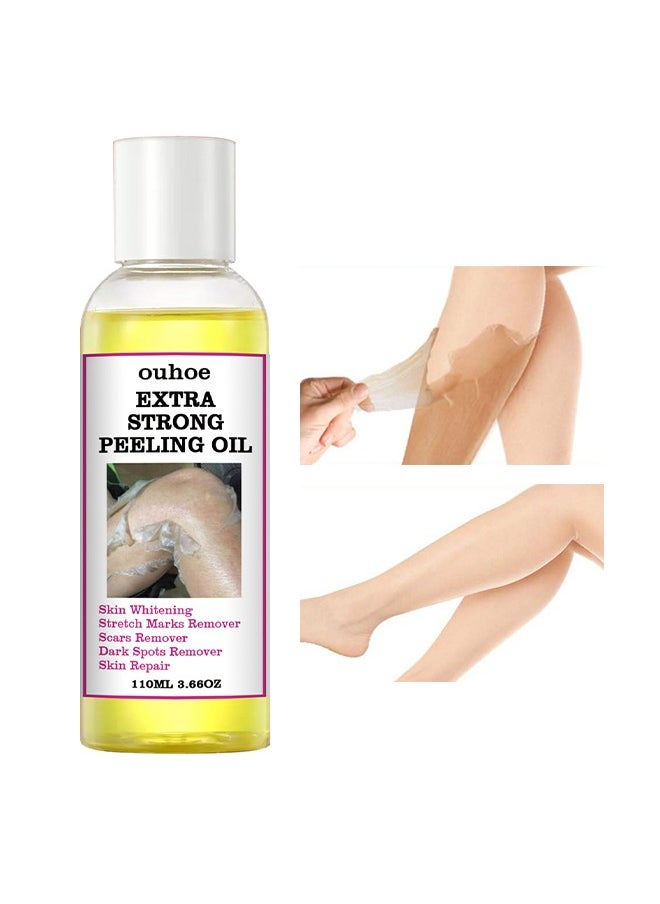 OUHOE Extra Strong Peeling Oil,Skin Whitening Stretoh Marks Remover Peeling Solution With Salicylic Acid, Dark Spot Corrector For Body, Skin Brightening Solution For Dull Skin (110Ml)  - Image 1