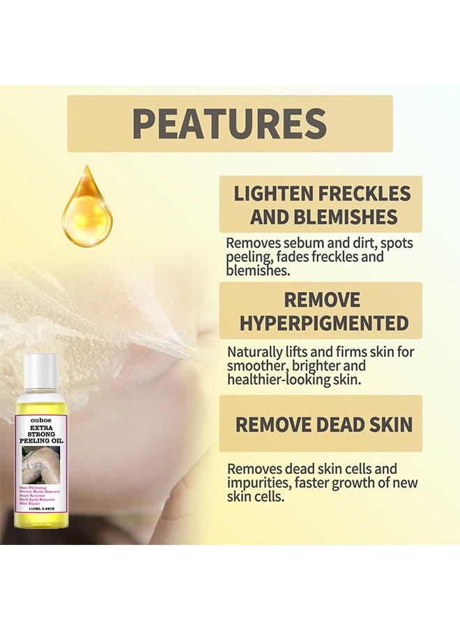 OUHOE Extra Strong Peeling Oil,Skin Whitening Stretoh Marks Remover Peeling Solution With Salicylic Acid, Dark Spot Corrector For Body, Skin Brightening Solution For Dull Skin (110Ml)  - Image 3