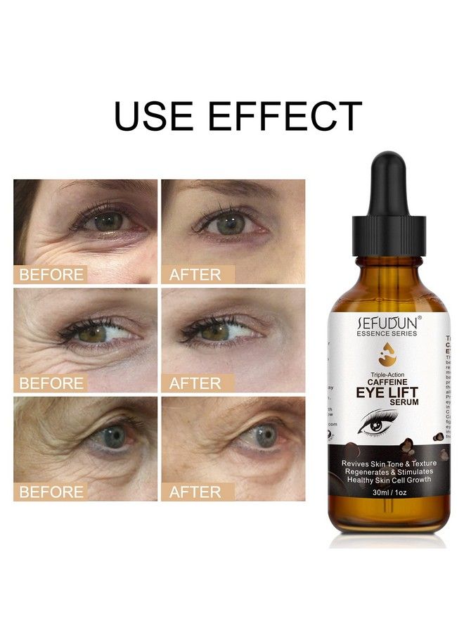 PEPHUCA Caffeine Eye Serumdark Circles Under Eye Treatment For Women With Vitamin Chyaluronic Acid Collagenanti Aging Eye Serum Reduces Puffiness Eye Bags Wrinkles And Fine Line  - Image 4