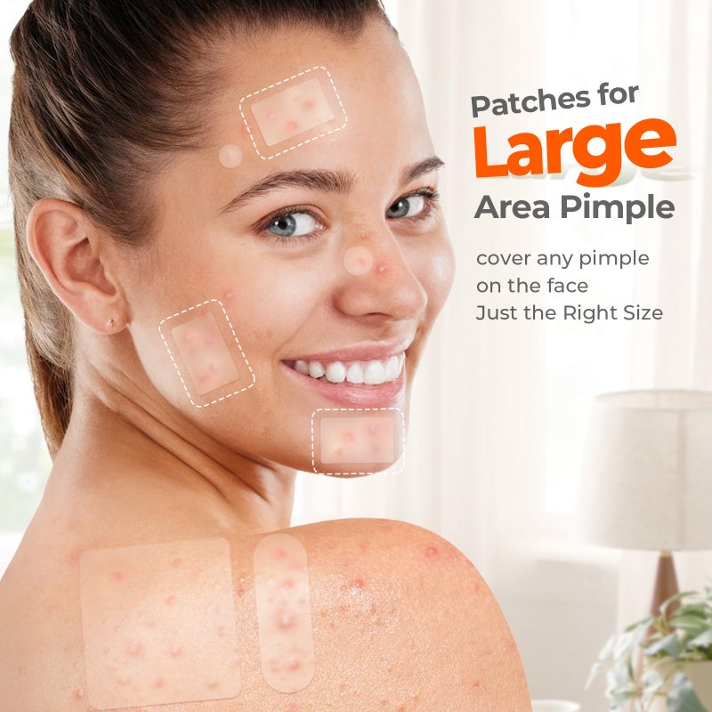 TKTK Large Pimple Patches for Face, 7 Sizes Big Acne Patches, FSA Eligible XL Hydrocolloid Bandages for Body, Chin, Forehead, Nose, Blemish Zit Breakouts, Hydrocolloid Patch (Square, Strip, Dot 142 Count) - Image 3