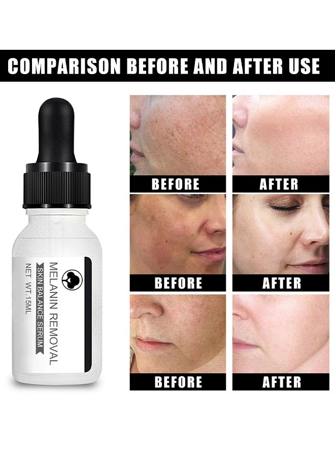 إيلهو سيروم توازن البشرة لإزالة الميلانين، سيروم النياسيناميد، سيروم تفتيح الوجه وتصحيح البقع الداكنة، كريم وجه مضاد للشيخوخة لتفتيح وترطيب البشرة، سيروم تصحيح بقع الشمس والتقدم في العمر، يقلل من الاسمرار والكلف والنمش وبقع الشمس، يوحد لون البشرة - Image 2