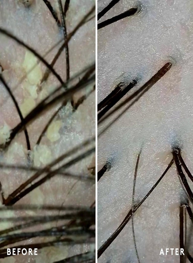 VIRTUE Scalp Remedy Conditioner 198ml â€“ Fragrance-Free, Microbiome Balancing, Color Safe, For Dry, Oily & Irritated Scalps - Image 4