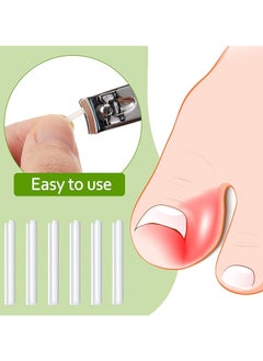 KASTWAVE Ingrown Toenail Corrector Strips Toenail Correction Patches Curved Toenails Straightening Recover Clips Thick Paronychia Pedicure Tool Toenail Straightener Strip for Men Women Foot Care 100 Pieces  - Image 3