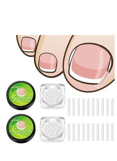 KASTWAVE Ingrown Toenail Corrector Strips Toenail Correction Patches Curved Toenails Straightening Recover Clips Thick Paronychia Pedicure Tool Toenail Straightener Strip for Men Women Foot Care 100 Pieces  - Image 1