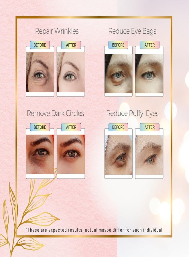 aalin Get Amazing Results 24K Gold Under Eye Hydrogel Patches[60Pcs] With Licorice Extract, Hyaluronic Acid, Collagen & Glycerin Specialized for Puffy Eyes, Dark Circles and Wrinkles - Image 4