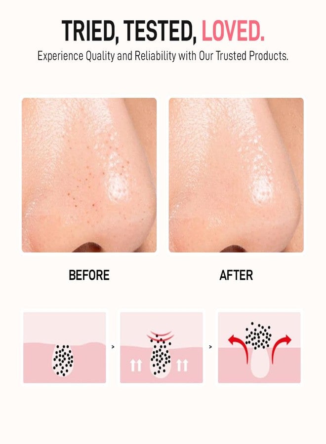 Multibrite Nose Exfoliator Brush, Gentle Facial Cleansing Tool with Soft Silicone Bristles, Deep Pore Cleanser, Blackhead Removal, Precise Exfoliation & Long-Lasting Skin Care - Image 5