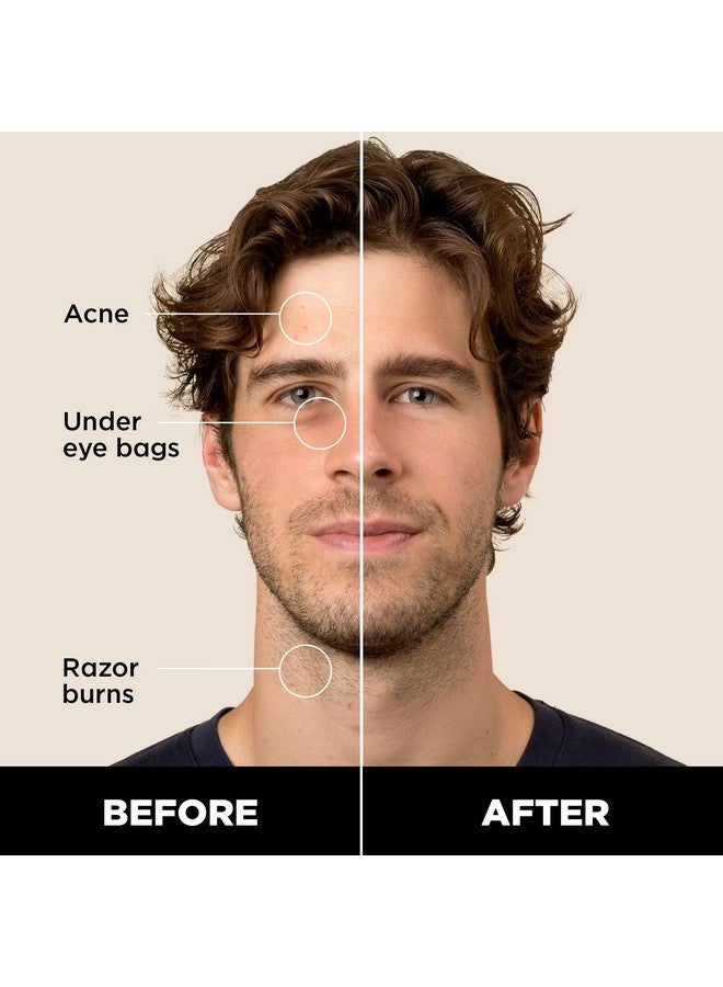 Stryx Concealer Stick Tool For Men, Light Cognac - Natural Pigments Hides Imperfections, Acne, Razor Burns, Scars, & Rosacea - Highly Adaptable Shades For Easy, Undetectable Coverage - All Skin Tones - Image 1