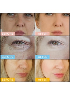 +1HEROLABS Face Serum Set - Retinol Serum, Vitamin C Face Serum & Hyaluronic Acid Serum for Face - Anti Aging Serum Skin Care Set for Women - Serum for Firm, Wrinkle Smoothing 3x1oz  - Image 3