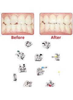 20 pieces, including tooth model mini bracket 022 slot glueable, with hook 345 - pzsku/Z2EBA318336E02AAA60CAZ/45/_/1693473572/c85f6d10-a0e5-46f8-98bf-212f908e8595