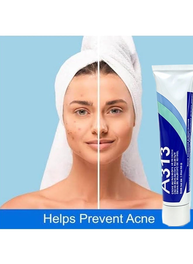 A313 Retinyl Palmitate Corrective Face Cream, Anti Aging Wrinkle Reducing Skin Repair Moisturizing Facial Treatment Cream Improve Rough Dull Uneven Skin Tone Firming Daily Skin Care Cream 50g - Image 2