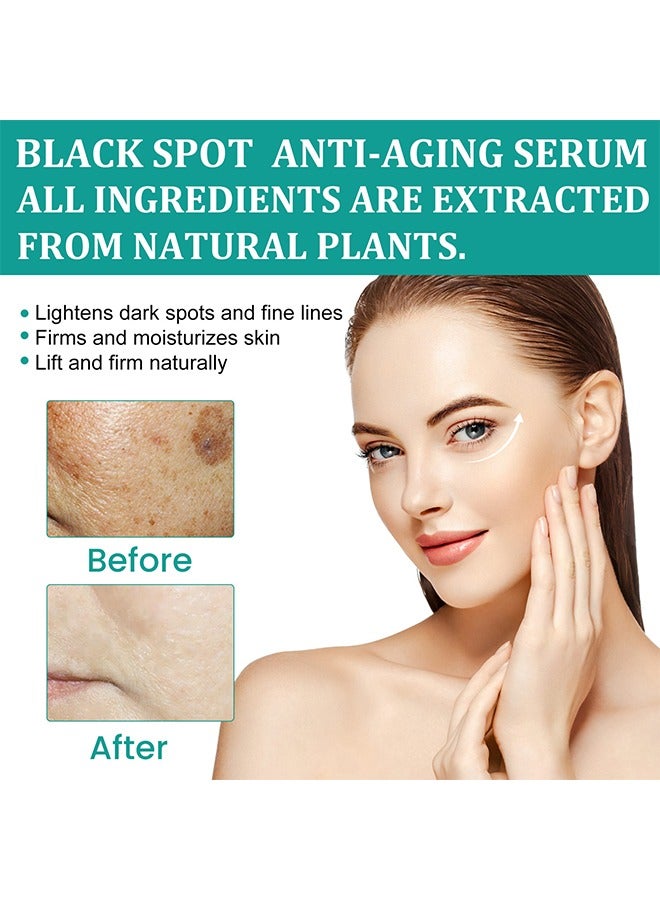 إيلهو سيروم بلاك سبوت مضاد للشيخوخة ، سيروم تفتيح البقع للوجه والجسم - سيروم تفتيح وتفتيح الوجه 30 مل - Image 2