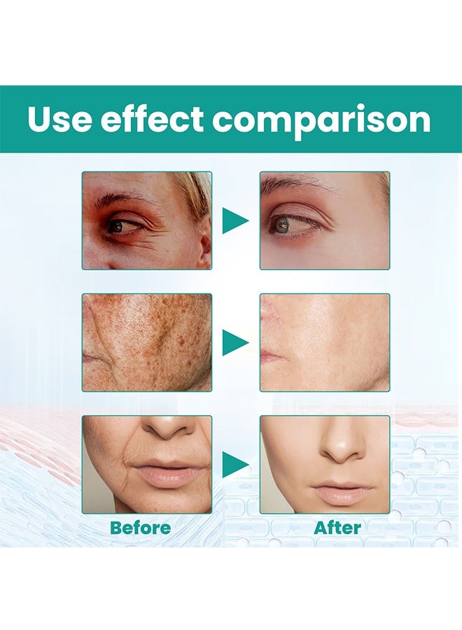 إيلهو سيروم بلاك سبوت مضاد للشيخوخة ، سيروم تفتيح البقع للوجه والجسم - سيروم تفتيح وتفتيح الوجه 30 مل - Image 4