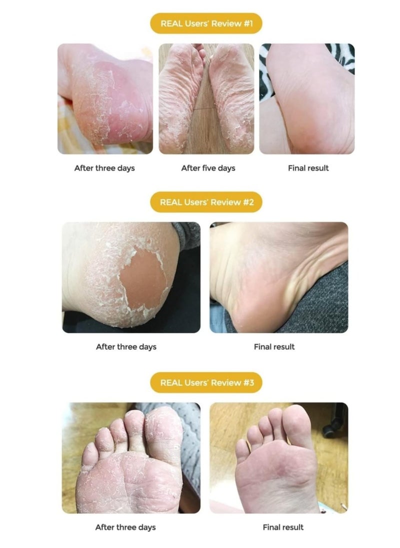 Purederm Exfoliating Foot Mask - 2 Pair  - Image 4