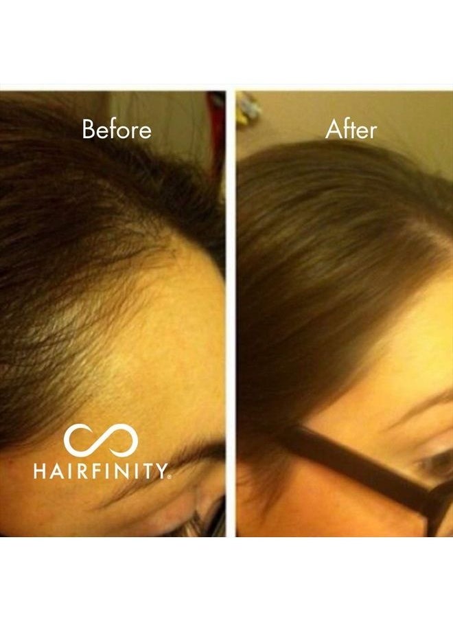 HAIRFINITY - Infinite Edges Hair Serum - Hair Growth Treatment to Prevent Hair Loss and Stimulate Hair Follicles to Stop Hair Loss and Regrow Hair - Targets Causes of Alopecia - Sulfate & Silicone Free - Image 1