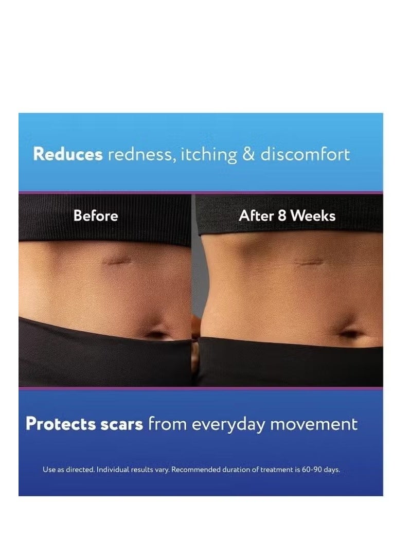 ScarAway Silicone ScarGel 20g - Image 3