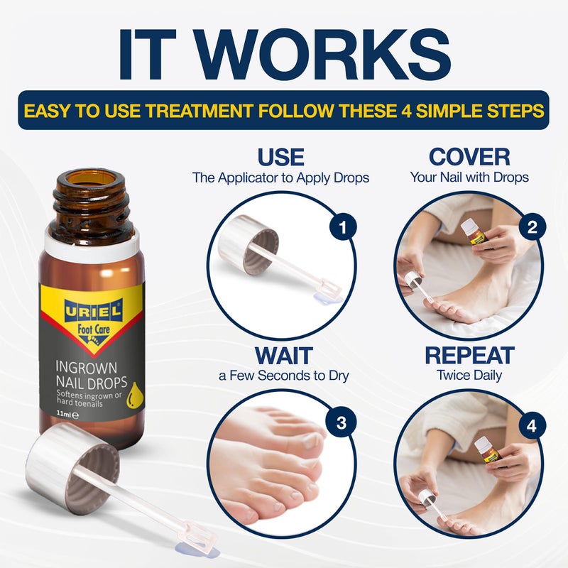 URIEL UPGRADED Ingrown Toenail Treatment, Ingrown Toenail Removal Kit, Ingrown Toenail Corrector, Ingrown Nail Kit Ingrown Toenail Tool 11 ml - Image 4