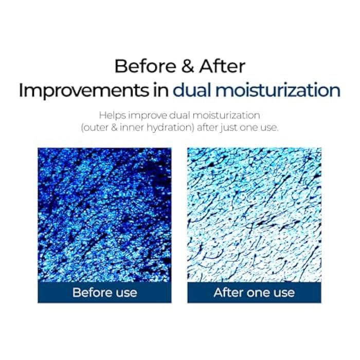 IZEZE Soul HNA Hydro Cream 1.69 fl.oz, 50 ml | Hyaluronic Acid Moisturizer Face Cream, Adenosine Facial Cream, Cypress Water, Korean Skincare for Dry Skin, Hydrating Cypress Extract - Image 5