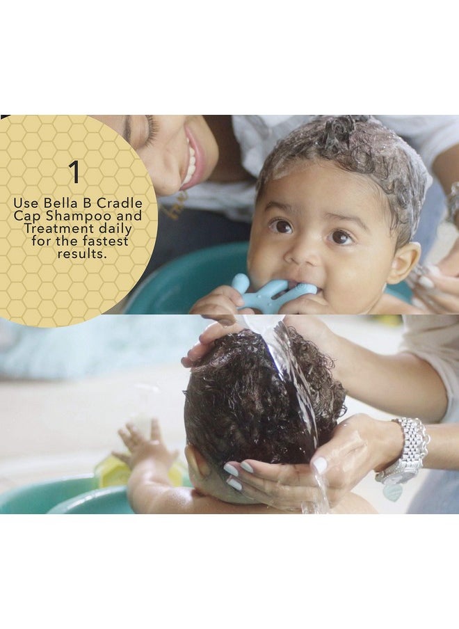 Cradle Cap Shampoo & Cradle Cap Scalp Treatment And Conditioner Baby Shampoo And Conditioner Cradle Cap Shampoo For Babies Kid Shampoo Dry Scalp Shampoo And Conditioner For Dry Scalp