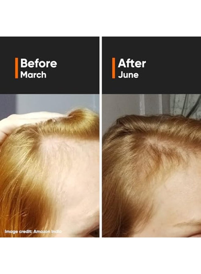 منيماليست سيروم كثافة الشعر 18% | مع بروكابيل، كابكسيل، ريئيندسيل، أناغين وبايكابيل للتحكم في تساقط الشعر ونمو الشعر للرجال والنساء | 30 مل - Image 2