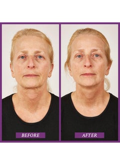 PRAI Beauty Ageless Throat Caviar Overnight Recovery Serum For Instantly Ageless Neck Neck Firming And Tightening Serum 1.7 Oz  - Image 2