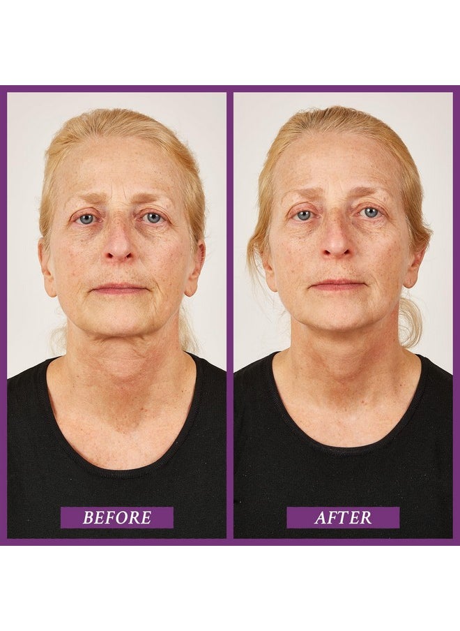 PRAI - Beauty Ageless Throat Caviar Overnight Recovery Serum For Instantly Ageless Neck Neck Firming And Tightening Serum 1.7 Oz - Image 1
