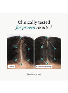 NUTRAFOL Nutrafol Women's Hair Growth Supplements, for Women Ages 18-44, Clinically Proven Hair Supplement for Visibly Thicker and Stronger Hair, Dermatologist Recommended - 1 Month Supply, 1 Refill Pouch  - Image 4