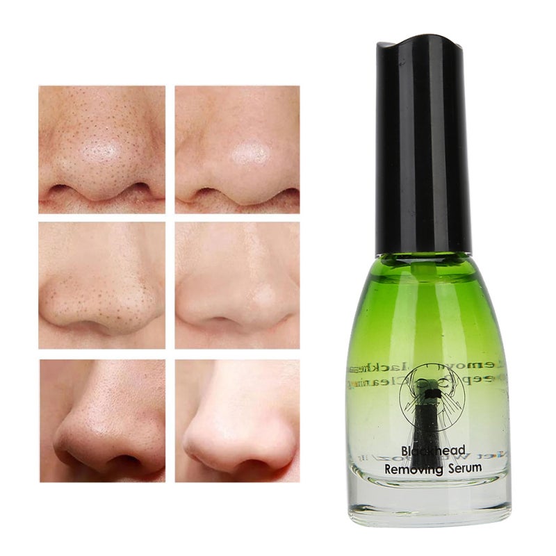 Blackhead Removing Serum: 100% Plant Extracts, Non-irritating, Quick Absorption - Deep Pore Cleaning, Pore Treatment for Face Skin Care - Image 4