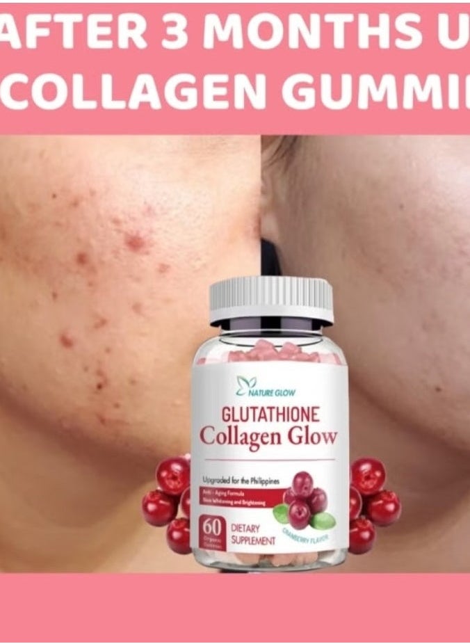 NATURE GLOW - Natural Glow Cranberry Collagen with Glutathione Gummies – Skin Whitening, Anti-Aging Superfoods with Vitamins – Boosts Immunity, Increases Energy, Moisturizes Skin – Removes Acne Marks, Dark Spots, Wrinkles – 60 Gummies - Image 1