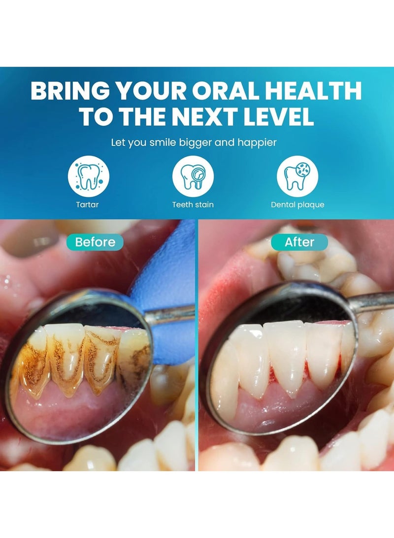 general Plaque remover kit, tooth cleaning tool kit with 3 modes, portable tooth stain removal tool, no water flosser required ith IPX6 waterproof/LED to remove food debris - Image 4