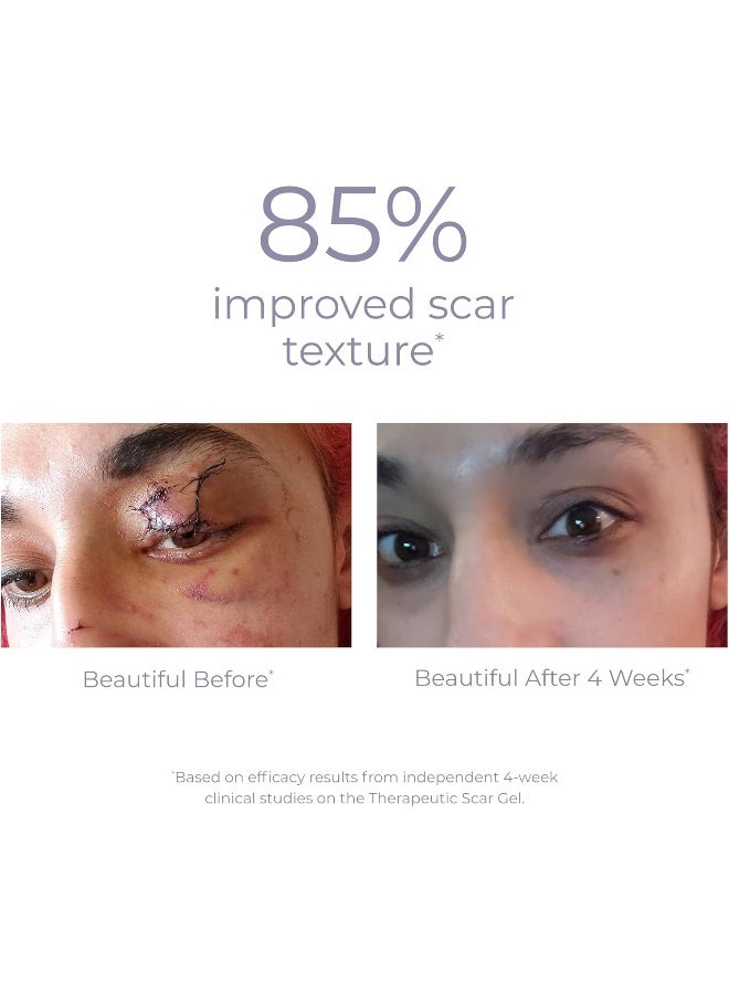 derma-e DERMA E Scar Gel - Image 5