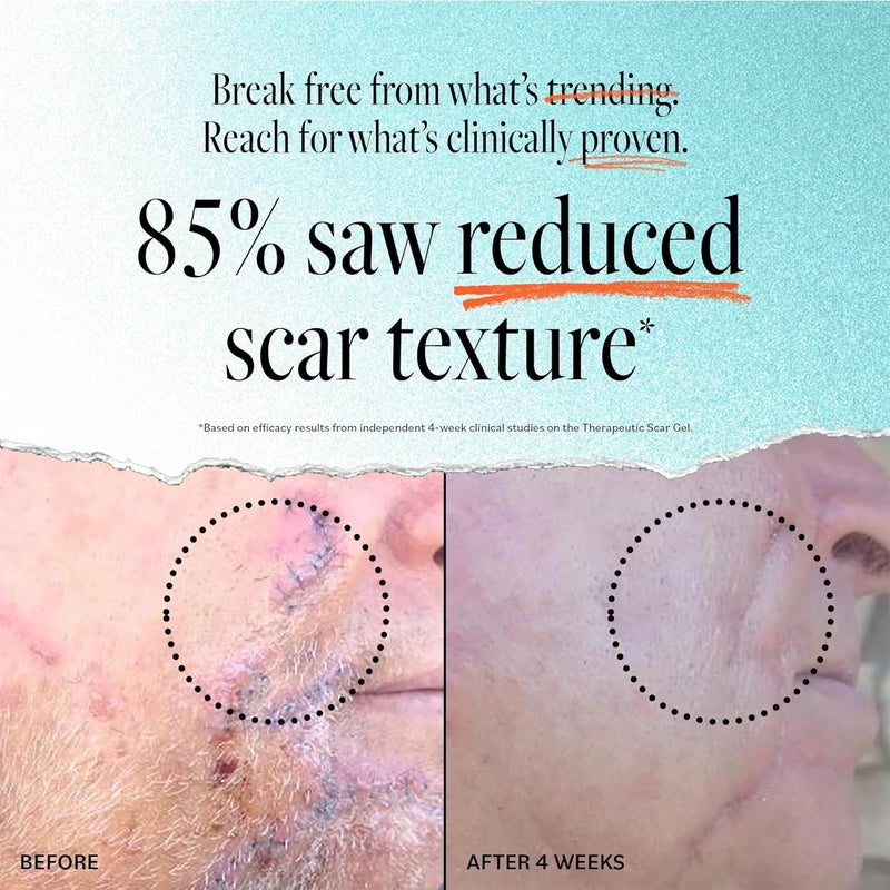 derma-e DERMA E Scar Gel - Image 3