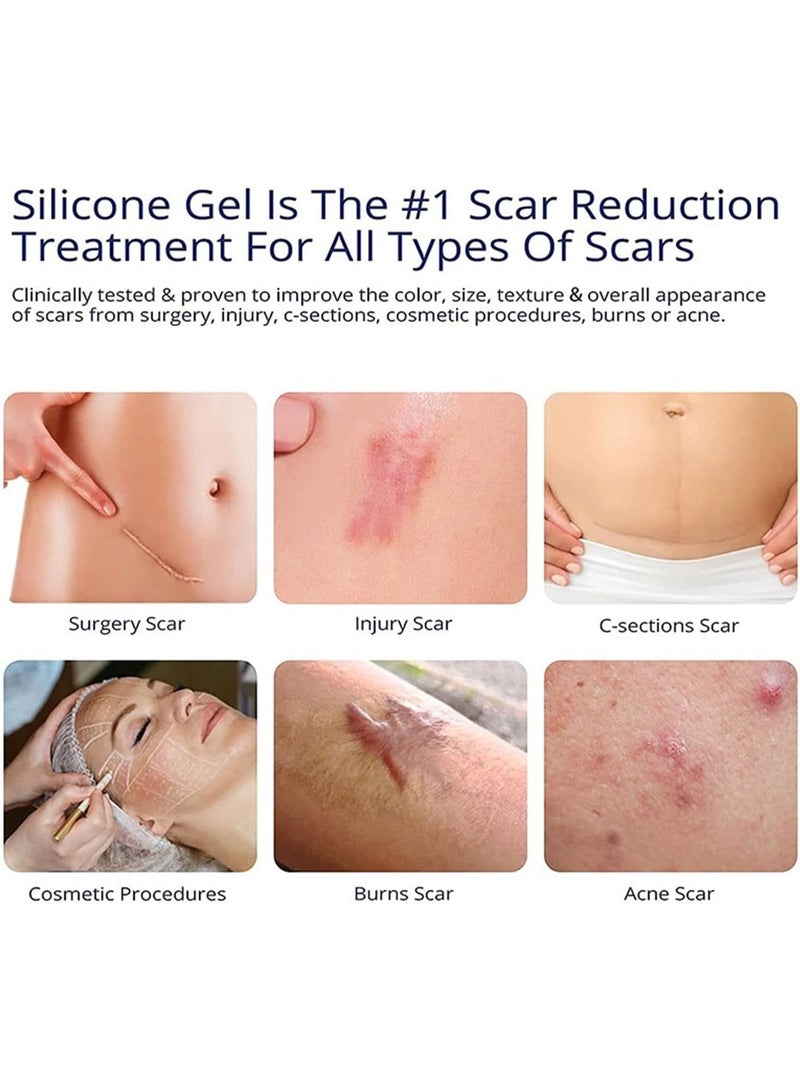 ASMOXA Silicone Scar Gel, Advanced Scar Cream for Surgical Scars, Burns, C-Section, Stretch Marks, Keloids, Fades Old  New Scars, Face  Body Scar Treatment, Smooths  Softens Skin, For Men  Women - Image 3