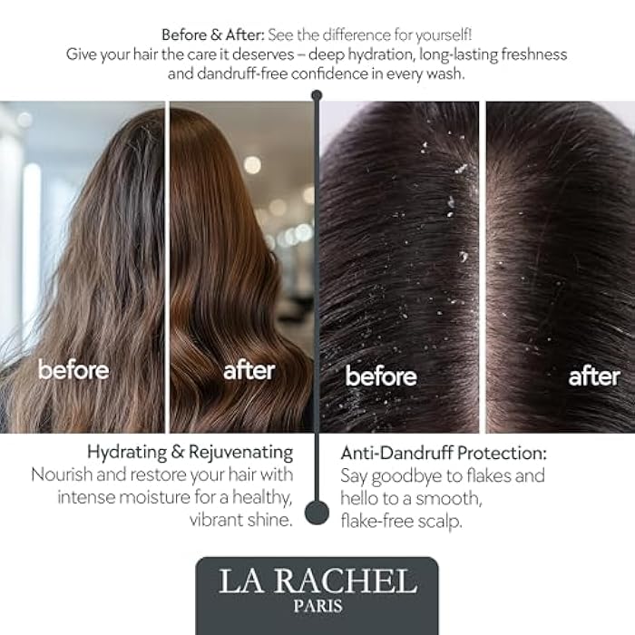 LA RACHEL شامبو LA RACHEL المضاد للقشرة بزيت الأركان والكيراتين | آمن للشعر الجاف والتالف والمعالج بالألوان | تركيبة مغذية خالية من الملح للقوة واللمعان | شامبو مكثف باريس - Image 3
