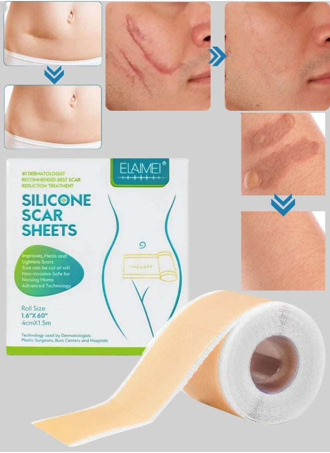 Elaimei - Silicone Scar Sheets Medical Grade Silicone Roll -1.5m,Silicone Scar Tape Keloid,C-Section,Surgical Scars Removal Scar Roll Silicon Gel Cream Patch Removes Abs Tuck Surgery Scars Scar Removal Strips - Image 1
