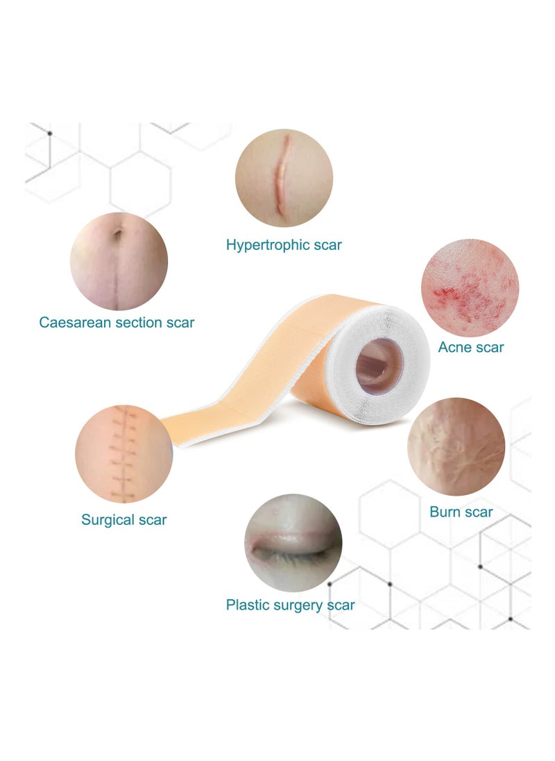 Elaimei - Silicone Scar Sheets Medical Grade Silicone Roll -1.5m,Silicone Scar Tape Keloid,C-Section,Surgical Scars Removal Scar Roll Silicon Gel Cream Patch Removes Abs Tuck Surgery Scars Scar Removal Strips - Image 1