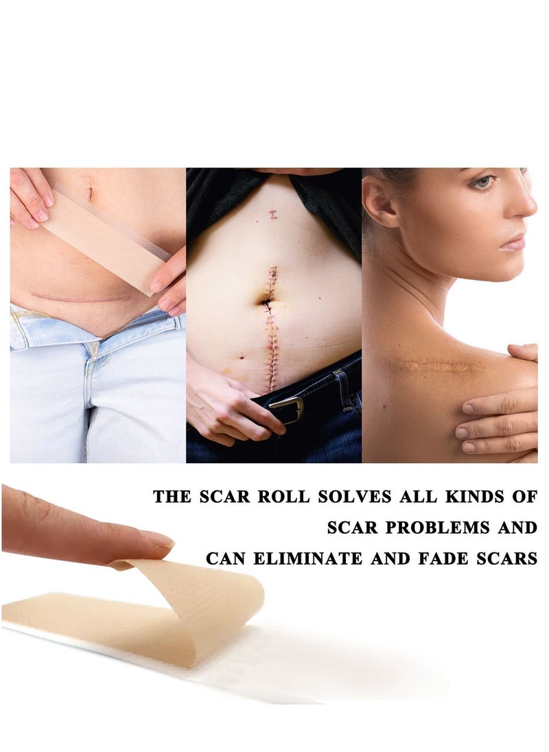 Elaimei - Silicone Scar Sheets Medical Grade Silicone Roll -1.5m,Silicone Scar Tape Keloid,C-Section,Surgical Scars Removal Scar Roll Silicon Gel Cream Patch Removes Abs Tuck Surgery Scars Scar Removal Strips - Image 1