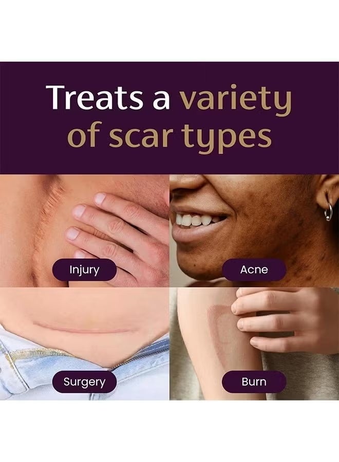 ميديرما كريم ميديرما الليلي المكثف لعلاج الندبات، علاج متطور للندبات يعمل مع نشاط تجديد البشرة أثناء الليل، 28 غرام، أبيض، 1 أونصة (عبوة واحدة) - Image 2