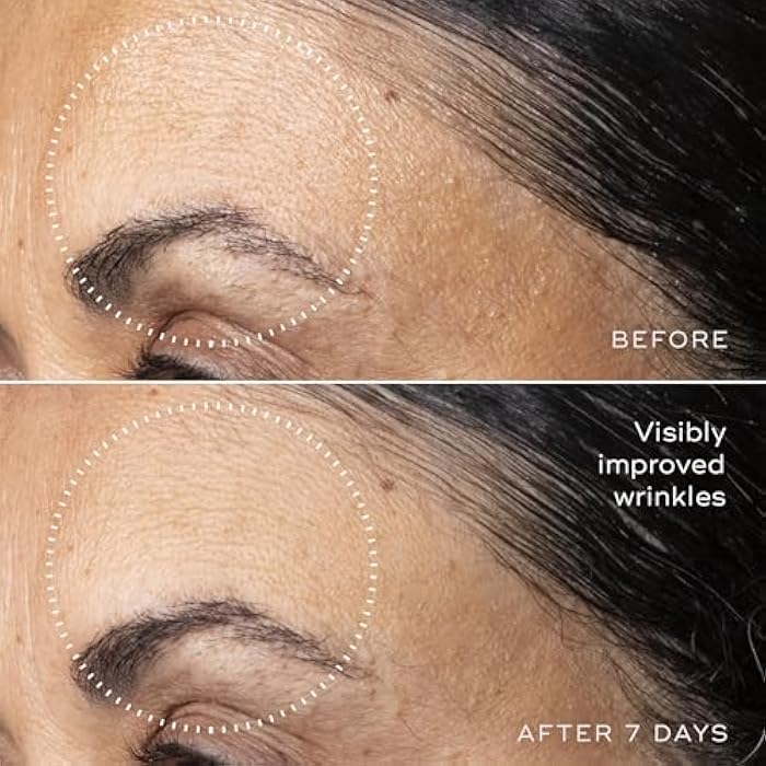 Medik8 C-Tetra Advanced - Balancing, Plumping, Hydrating Daily Vitamin C Serum with Hyaluronic Acid, Squalene - Smooths Fine Lines, Wrinkles - 1.0 oz - Image 5