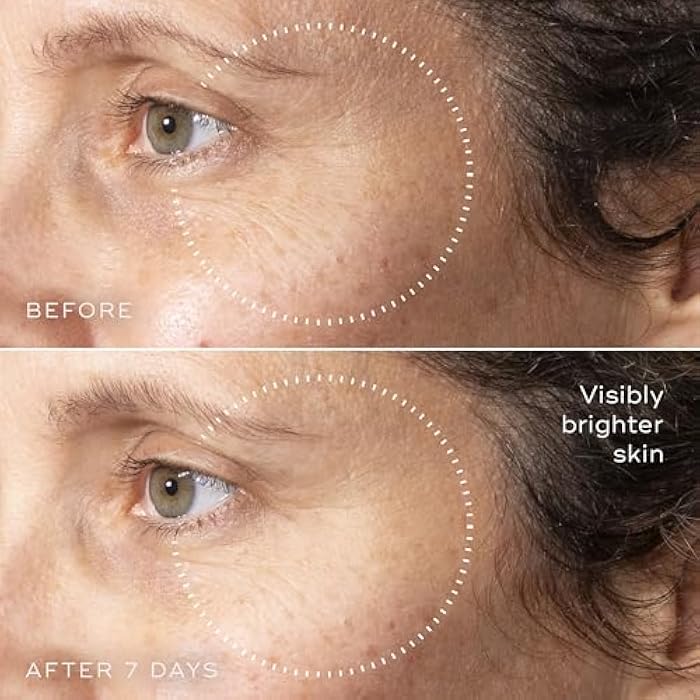 Medik8 C-Tetra Advanced - Balancing, Plumping, Hydrating Daily Vitamin C Serum with Hyaluronic Acid, Squalene - Smooths Fine Lines, Wrinkles - 1.0 oz - Image 3