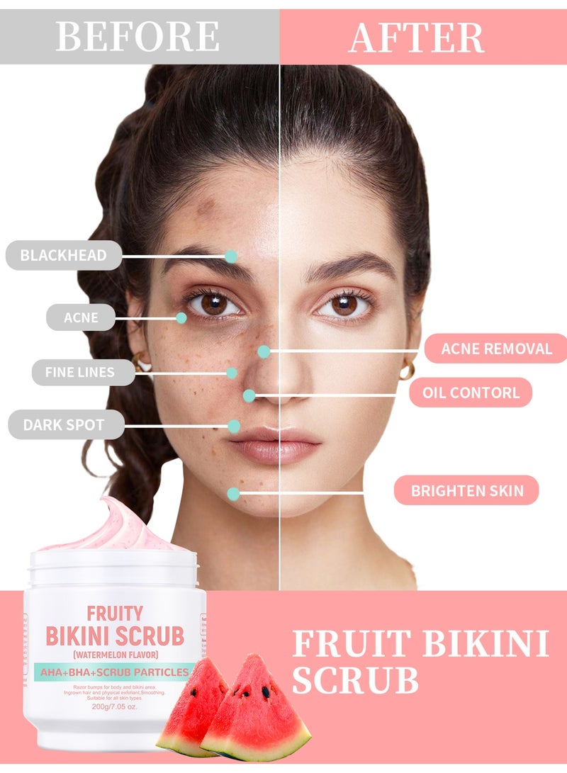 موويام مقشر فاكهي للبكيني مع أحماض ألفا هيدروكسي وأحماض بيتا هيدروكسي وجزيئات مقشرة لعلاج الشعر الناشئ تحت الجلد والنتوءات الناتجة عن الحلاقة مقشر للجسم ومنطقة البكيني لتنعيم جميع أنواع البشرة 200 جرام (بنكهة البطيخ) - Image 4