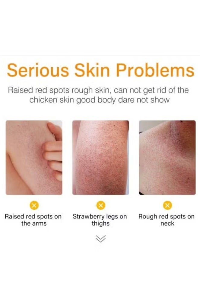 لانثوم علاج الساقين بالفراولة للنساء، كريم ترطيب الجسم من الفراولة، كريم ترطيب الجسم من التقرن الجاف، مرطب الجسم لتفتيح المناطق الجافة - Image 3