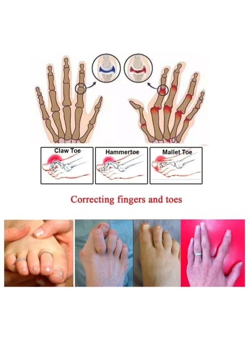 8-Piece Toe Splint Wraps Non Slip Hammer Straightener For Broken Crooked Overlapped And Toes-Women Men - Image 4