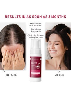 CARVENCHY 5% Minoxidil Foam for Hair Thinning and Hair Loss, Revivies And Restores Hair Follicles,Hair Growth Treatment for Women's Thicker and Fuller Hair,Easy-to-use Foam 2 Pack of 60g  - Image 4
