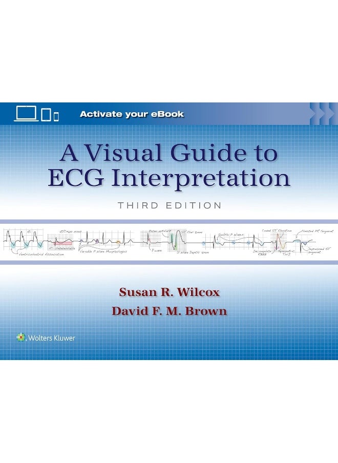 A Visual Guide to ECG Interpretation: Print + eBook with Multimedia 