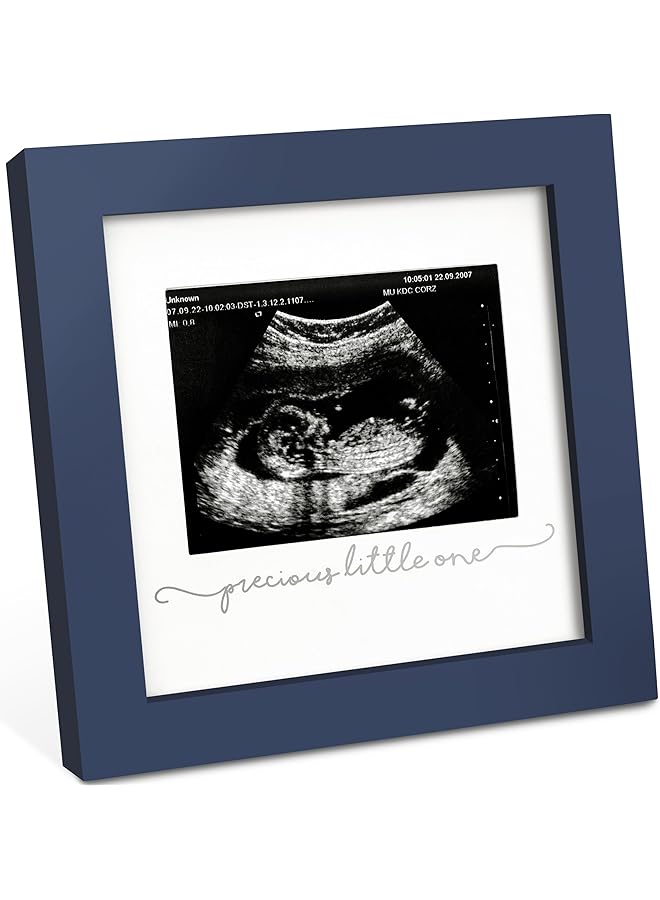 إيروريكس إطار صور سونار الطفل إطار الموجات فوق الصوتية الحديث للأم الحامل إطارات صور سونار الإعلان عن الحمل الكشف عن جنس الطفل للآباء والأمهات المتوقعين هدايا للأب لأول مرة أزرق داكن - Image 1
